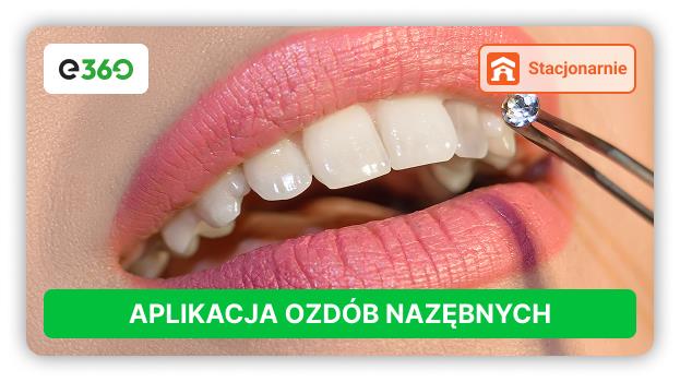 Nowość! Kurs Aplikacji Ozdób Nazębnych.